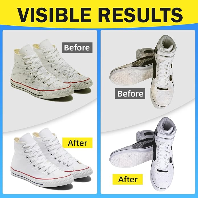 Shoe Cleaner Kit – Foam Cleaner for White Shoes & Sneakers, 6.76 fl oz | Fast Dirt And Stain Removal, Anti-Yellowing Care For Leather, Canvas, Mesh, Knit And Rubber, Brush & Towel Included
